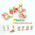 TOOTH04(12577) Stained Root Canal Endodontic Tooth Model for Root Canla Filling Training, Endo teeth